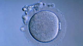 A human egg