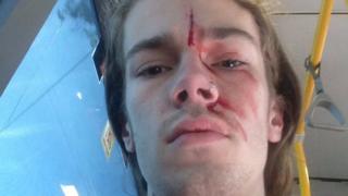 A photo of Kevin Rudd's godson, Sean, with a bloody face
