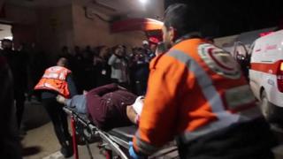 A person injured in Maghazi is brought to Al-Aqsa Hospital