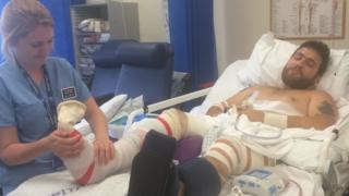 Chris Dos Santos in hospital