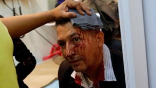 Un diputado herido