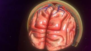 Cerebro