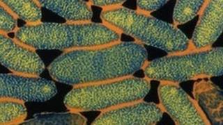 Legionnaires' Disease picture