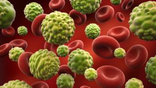 Representação de células cancerígenas no sistema sanguíneo.