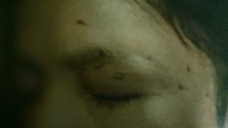 her injuries