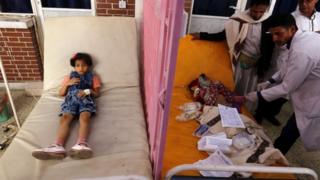 Йеменские врачи лечат больных детей
