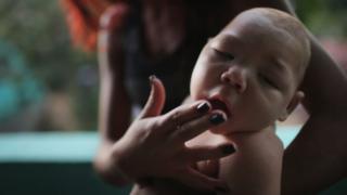 Эстафани Перрейра держит своего племянника Дэвида Энрике Феррейра, 5 месяцев, у которого есть микроцефалия, 25 января 2016 года в Ресифи, Бразилия.