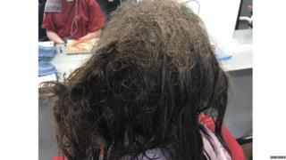 डिप्रेशन, मानसिक स्वास्थ्य, खूबसूरती