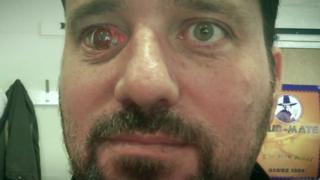 EYEBRG