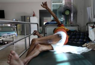 เอดส์ เอชไอวี วัดพระบาทน้ำพุ HIV AIDS Wat Phra Baht Nam Phu