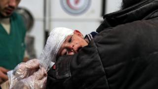 Пострадавшая девятимесячная девочка получает медицинскую помощь в полевом госпитале в удерживаемой повстанцами Думе, Сирия (26 ноября 2017 года)
