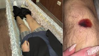 Даже эти травмы, как уверены родственники, доказывают, что Сарычева били непосредственно перед смертью