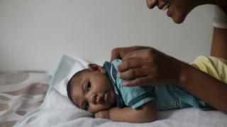 Lucas, que tem microcefalia, brinca com sua mãe, Míriam