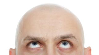 Bald man