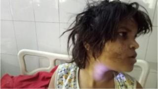 দুই মাস ধরে হাসপাতালে চিকিৎসাধীন আছে শিশুটি