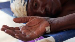 Mutane sun kamu da Cholera a wajen wani taro a Kenya