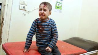 Injured boy in rebel held east Aleppo, 18 Nov
