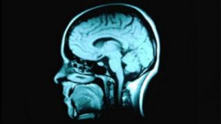 brain