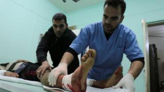 مصاب فلسطيني