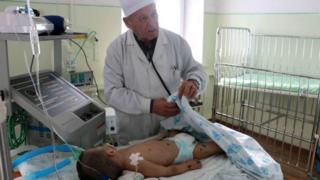 Доктурлар баланын денесинде аесуз уруп сабалган, атүгүл зордукталган белгилер бар деп шектенишкен