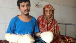 অপারেশনের পর মায়ের সাথে বসে আবুল বাজানদার।