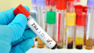 Amostra com vírus Zika