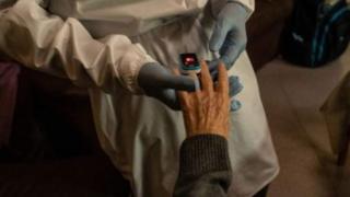 A woman's hand undergoes a medical examination.