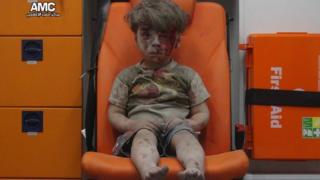 17日のアレッポ空爆で負傷したという5歳のオムラン・ダクニーシュちゃんの写真を、反政府組織「アレッポ医療センター」が公表した。