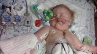 Artificial heart keeps boy alive for record 251 days - BBC News