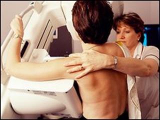 Breast screening