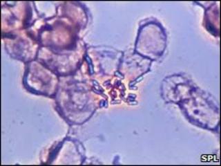 E. coli bacteria in the bloodstream