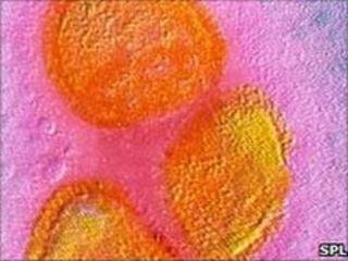 Mumps virus