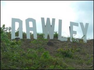 Dawley sign