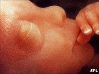 Foetus at 12 weeks