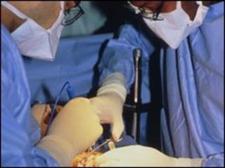Transplant operation