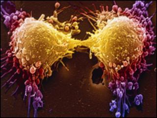Cancer cell dividing, SPL