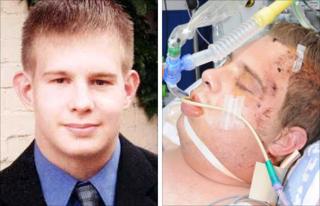 David Baker before and after the attack that left him in a coma