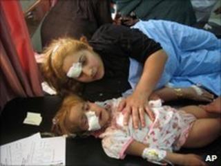 A wounded Iraqi woman and her daughter are treated at a hospital after a car bombing in Tuz Khormato, in northern Iraq