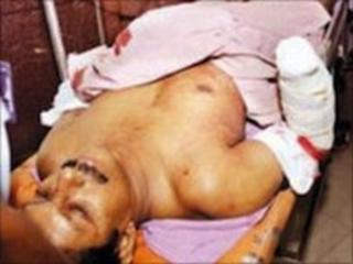 Prof Joseph in hospital