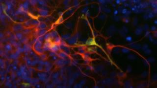 Dopamine neurons generated from human stem cells