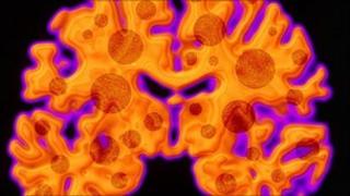 Brain