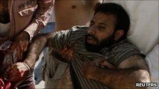 An injured man in Srinagar on 2 August 2010