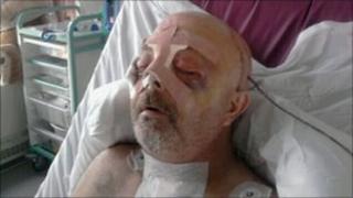 Michael Brown in hospital