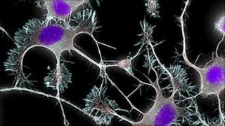Brain works more like internet than 'top down' company Brain works more like internet than 'top down' company