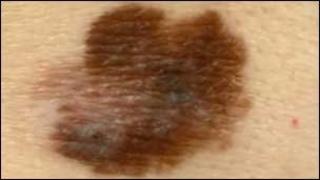 mole