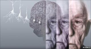 A man's brain