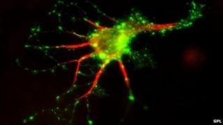 Cell structure, fluorescent micrograph