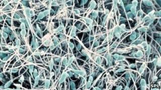 Sperm