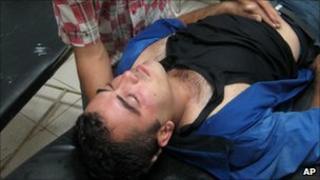 A wounded man is comforted in hospital after attacks on jewellery shops in Kirkuk