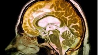 Brain scan